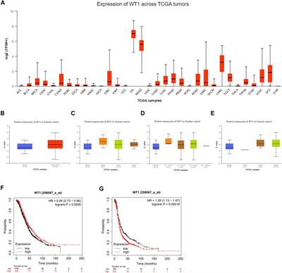 Application of Bioinformatics Analysis to Identify Important Pathways and Hub Genes in Ovarian Cancer Affected by WT1